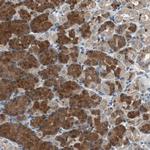 PI4KB Polyclonal Antibody