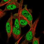 TNRC4 Antibody in Immunocytochemistry (ICC/IF)