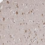 TNRC4 Antibody in Immunohistochemistry (IHC)