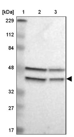 GPANK1 Antibody in Western Blot (WB)