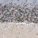 MYT1 Antibody in Immunohistochemistry (IHC)