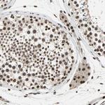 ISY1 Antibody in Immunohistochemistry (IHC)