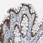 RBM47 Antibody in Immunohistochemistry (Paraffin) (IHC (P))