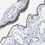 RBM47 Antibody in Immunohistochemistry (Paraffin) (IHC (P))