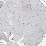 RBM47 Antibody in Immunohistochemistry (Paraffin) (IHC (P))