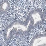 RBM47 Antibody in Immunohistochemistry (IHC)