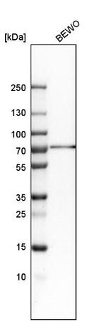 RBM47 Antibody in Western Blot (WB)