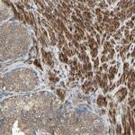 POLRMT Antibody in Immunohistochemistry (Paraffin) (IHC (P))