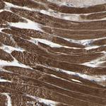 POLRMT Antibody in Immunohistochemistry (Paraffin) (IHC (P))
