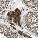 POLRMT Antibody in Immunohistochemistry (Paraffin) (IHC (P))