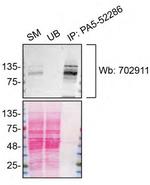 ADNP Antibody in Immunoprecipitation (IP)
