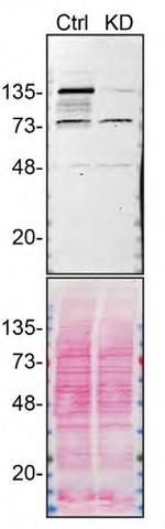 ADNP Antibody in Western Blot (WB)