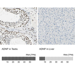 ADNP Antibody in Immunohistochemistry (Paraffin) (IHC (P))