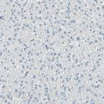 ADNP Antibody in Immunohistochemistry (Paraffin) (IHC (P))