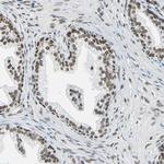 ADNP Antibody in Immunohistochemistry (Paraffin) (IHC (P))