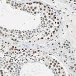 ADNP Antibody in Immunohistochemistry (Paraffin) (IHC (P))