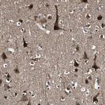 PPP1R13B Antibody in Immunohistochemistry (Paraffin) (IHC (P))