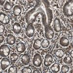 PPP1R13B Antibody in Immunohistochemistry (Paraffin) (IHC (P))