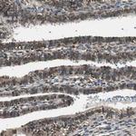 PPP1R13B Antibody in Immunohistochemistry (Paraffin) (IHC (P))