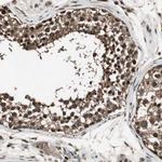 PPP1R13B Antibody in Immunohistochemistry (Paraffin) (IHC (P))