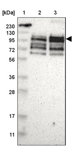 PPP1R13B Antibody in Western Blot (WB)