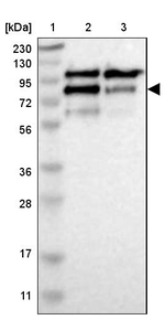 CNOT3 Antibody in Western Blot (WB)