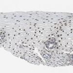 GRHL1 Antibody in Immunohistochemistry (Paraffin) (IHC (P))