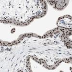 GRHL1 Antibody in Immunohistochemistry (IHC)
