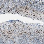 GRHL1 Antibody in Immunohistochemistry (IHC)