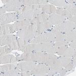 GRHL1 Antibody in Immunohistochemistry (IHC)