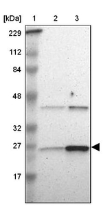 Adenylate Kinase 1 Antibody in Western Blot (WB)