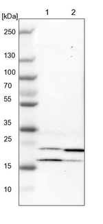 Adenylate Kinase 1 Antibody in Western Blot (WB)