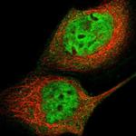 ECD Antibody in Immunocytochemistry (ICC/IF)