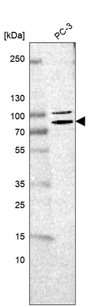 ECD Antibody in Western Blot (WB)