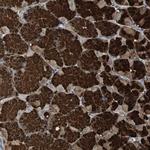 ZNF50 Antibody in Immunohistochemistry (Paraffin) (IHC (P))