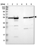 ZNF50 Antibody in Western Blot (WB)