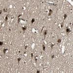 TAF5 Antibody in Immunohistochemistry (Paraffin) (IHC (P))