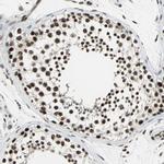 TAF5 Antibody in Immunohistochemistry (Paraffin) (IHC (P))