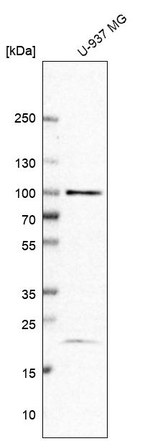 TAF5 Antibody in Western Blot (WB)