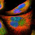 PFDN1 Polyclonal Antibody