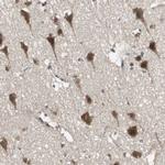 PFDN1 Antibody in Immunohistochemistry (Paraffin) (IHC (P))