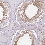 TBC1D9 Antibody in Immunohistochemistry (IHC)