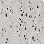 MIS18BP1 Antibody in Immunohistochemistry (Paraffin) (IHC (P))