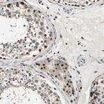 MIS18BP1 Antibody in Immunohistochemistry (Paraffin) (IHC (P))