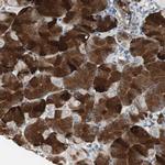 JTB Antibody in Immunohistochemistry (Paraffin) (IHC (P))