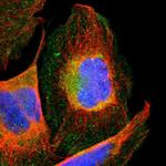 TCP-1 gamma Polyclonal Antibody