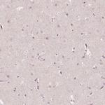 ACACB Polyclonal Antibody