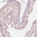 ACACB Antibody in Immunohistochemistry (Paraffin) (IHC (P))