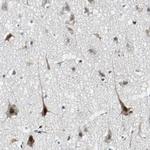 TAF6 Antibody in Immunohistochemistry (Paraffin) (IHC (P))