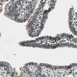 TAF6 Antibody in Immunohistochemistry (Paraffin) (IHC (P))